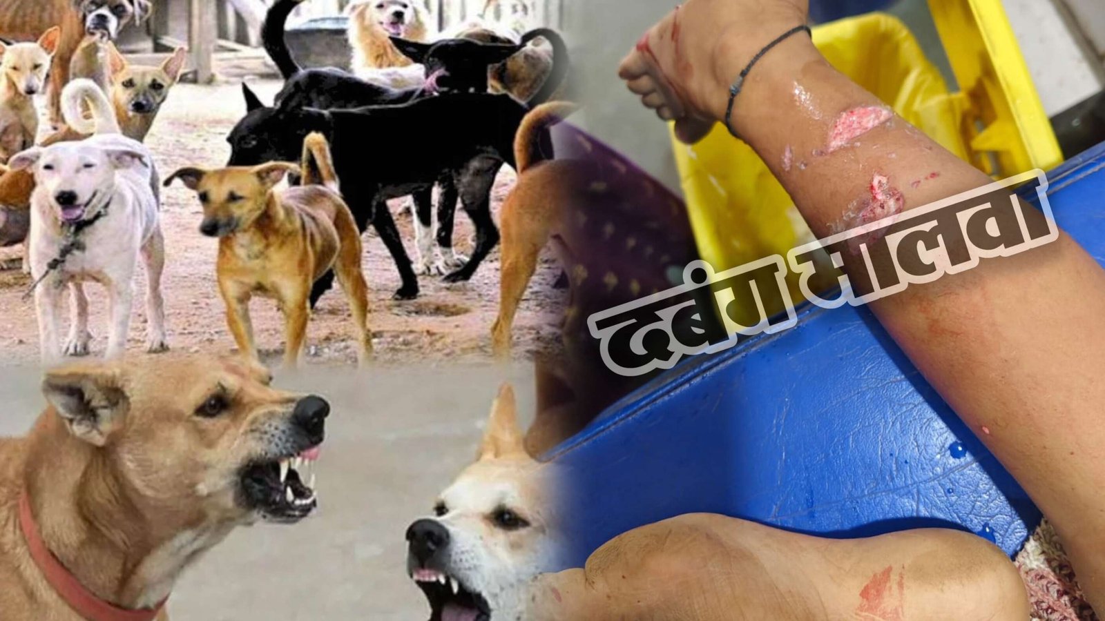सरवानिया महाराज नगर में आवारा कुत्ते के आतंक से लोगों में दहशत का माहौल, बच्ची को किया घायल